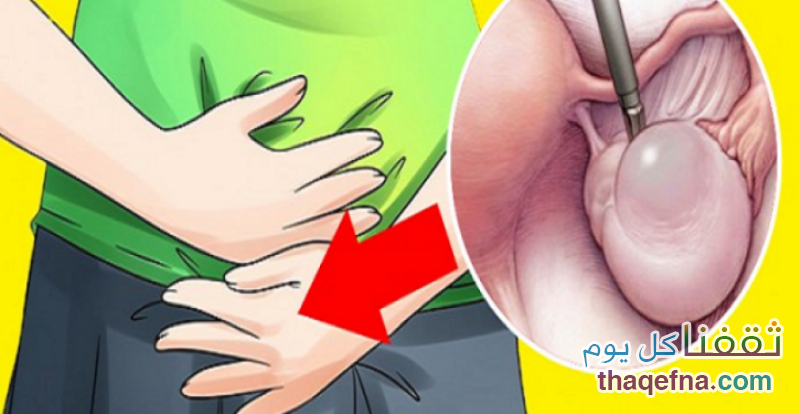 أفضل الحلول الطبيعية من أجل التخلص من خراجات الرحم المزعجة “الكيست”