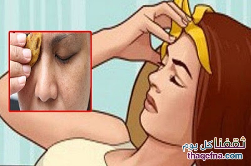 فوائد غير متوقعة من وضع قشور الموز على فروة الرأس . . . حقائق علمية ! !
