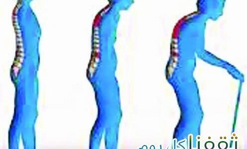 ثلاثة أطعمة كفيلة بحمايتك من هشاشة العظام وتحميكم من أمراض الشيخوخة