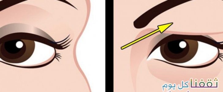 أفضل طريقة من أجل التخلص من تدلي الجفون بطريقة طبيعية ودون اللجوء الى الجراحة