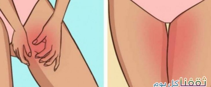 تعرفوا معنا على خمسة طرق فعّالة من أجل التخلص من إحتكاك الفخذين المزعج