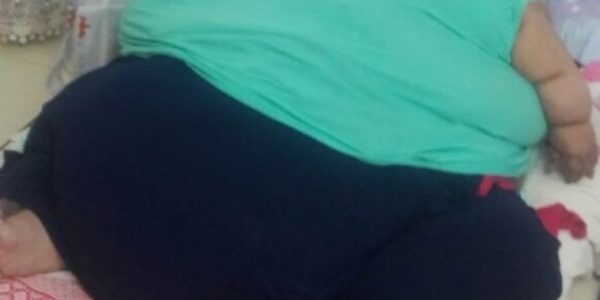 أسمن إمرأة مصرية تخسر 40 كيلو من وزنها في أول أسبوع لها بالمستشفى الهندية ونشاطها يتجدد