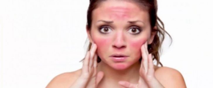أفضل قناع طبيعي من أجل التخلص من آثار وحروق الشمس والنتائج سريعه ومذهلة !!
