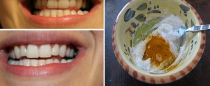 غسول ومبيض أسنان طبيعي من مكونات منزلية والنتائج سريعة ومذهلة !
