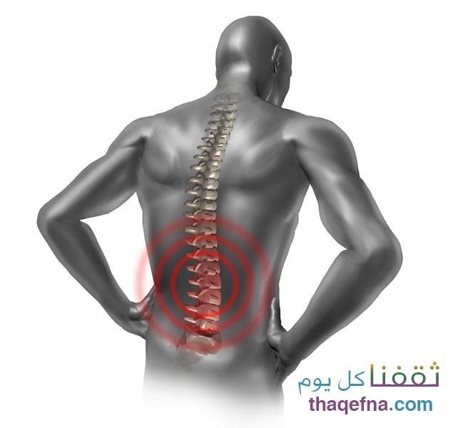 التخلص من آلام الظهر المستمرة إليك بعض النصائح البسيطة
