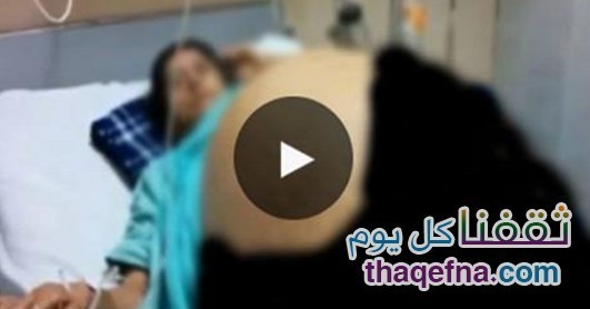إمرأة فجأة حدث انتفاخ فى بطنها و تزن أكثر من 275 كيلو !! تعرفوا ماذا وجدو داخل جسمها