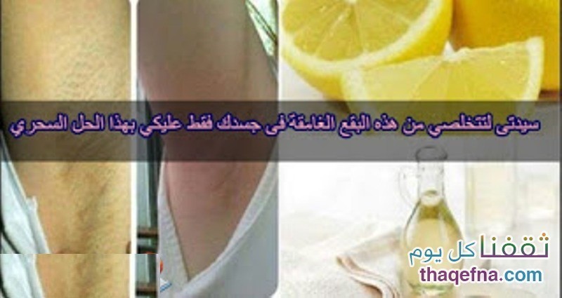 التخلص من البقع الغامقة بالجسم بالوصفة السحرية وبمكونات بسيطة جداً