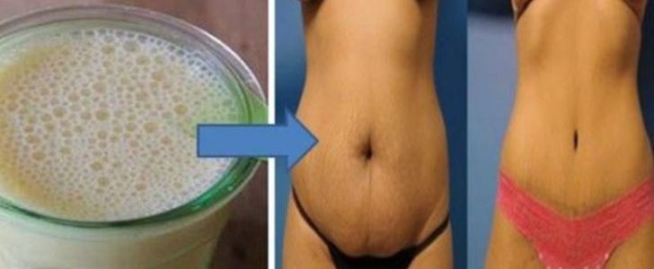 سيدة تخلصت من دهون البطن خلال 10 أيام باستخدام خلطة سحرية بسيطة ونتائج سريعة !
