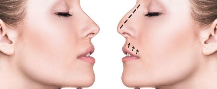 موقع الدكتور نزار فقيه لعمليات التجميل الأنف والأذن