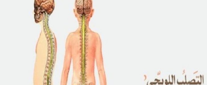 أفضل المستشفيات لعلاج وتشخيص مرض التصلب المتعدد اللويحي؟